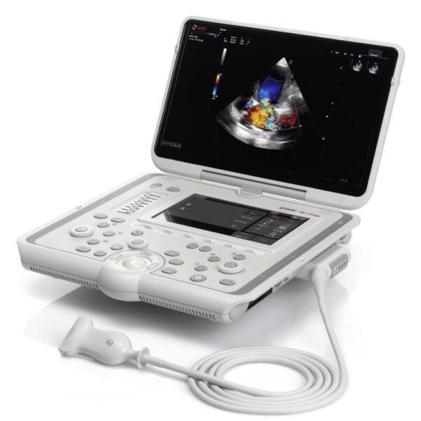 Esaote MyLab Omega
